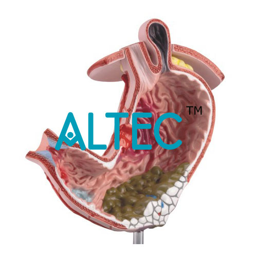 Gastric Diseases Model