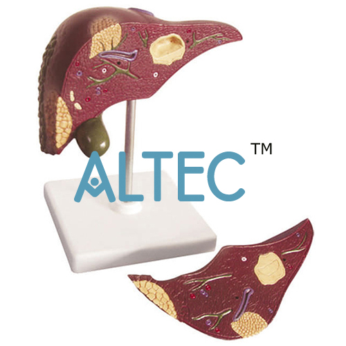 Pathological Model Of The Human Liver