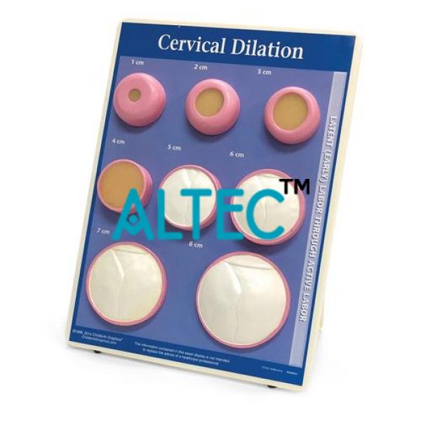 Cervical Dilatation Model