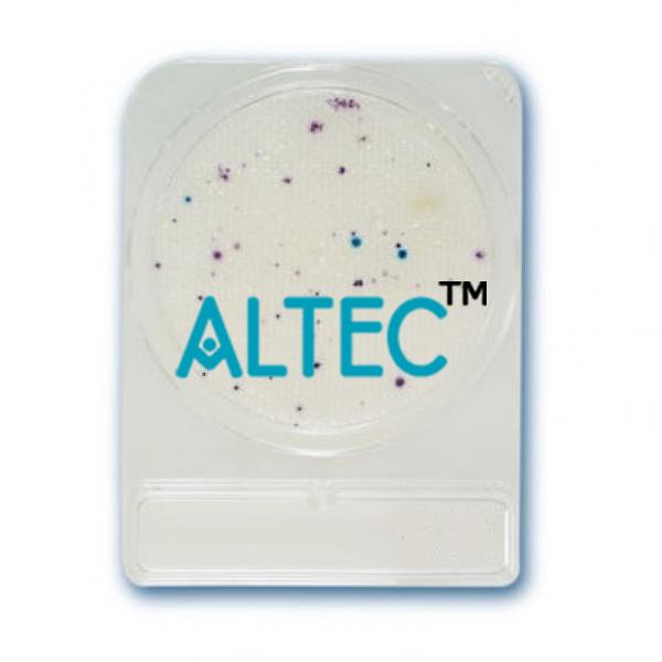 Bacteria Testing E-Coli