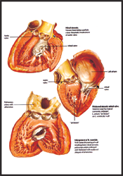 Human Diseases 3D Charts