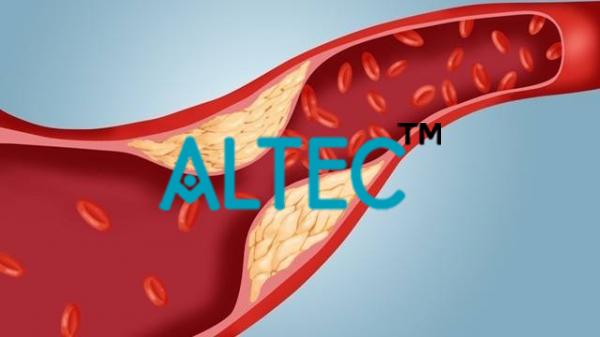 Lipid Profile